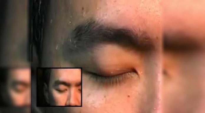 Cacing keluar dari muka?