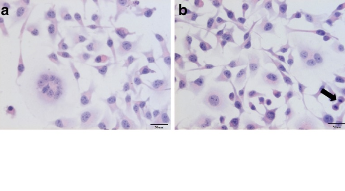 Vaccine associated sarcoma (VAS)
