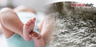 Dera bayi: Dimandikan dengan air panas
