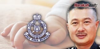 Bayi putus tangan digigit anjing milik keluarga