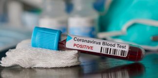 National shuttle M. Thinaah tests positive for Covid-19