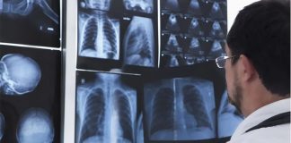Home quarantine patients need to monitor for happy hypoxia