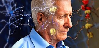 Early intervention can make a difference in Alzheimer prevention