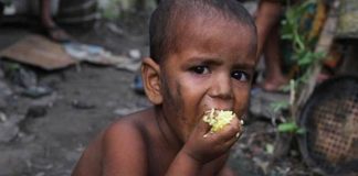 UNICEF calls for more efforts to stem child malnutrition