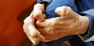 Eliminate discrimination against leprosy patients – Minister