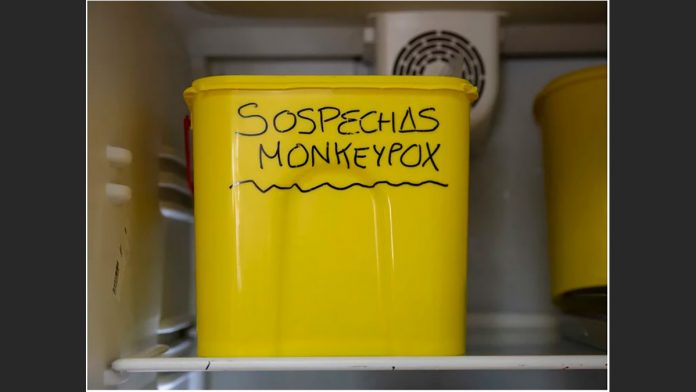 14072022monkeypox