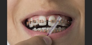 Don’t be deceived by fake dental braces by uncertified dentists