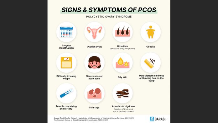 13072023PCOS