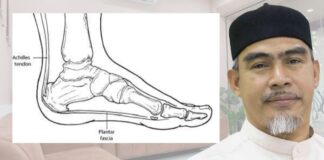 Plantar fasciitis: Musuh senyap wanita berusia