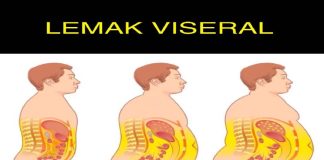 Lemak viseral punca pelbagai penyakit kronik